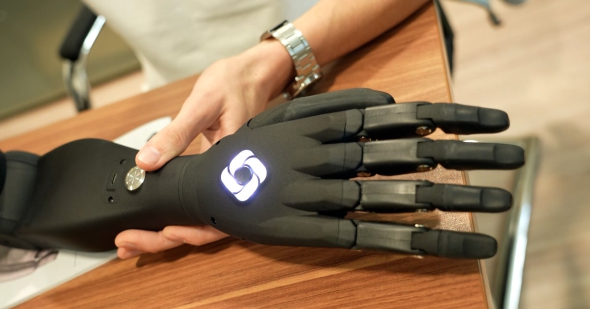 Countless Ukrainians Need Prosthetics. Homegrown Start-Ups Are Supplying Them