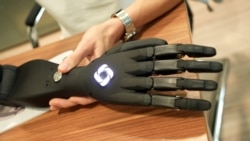 Countless Ukrainians Need Prosthetics. Homegrown Start-Ups Are Supplying Them