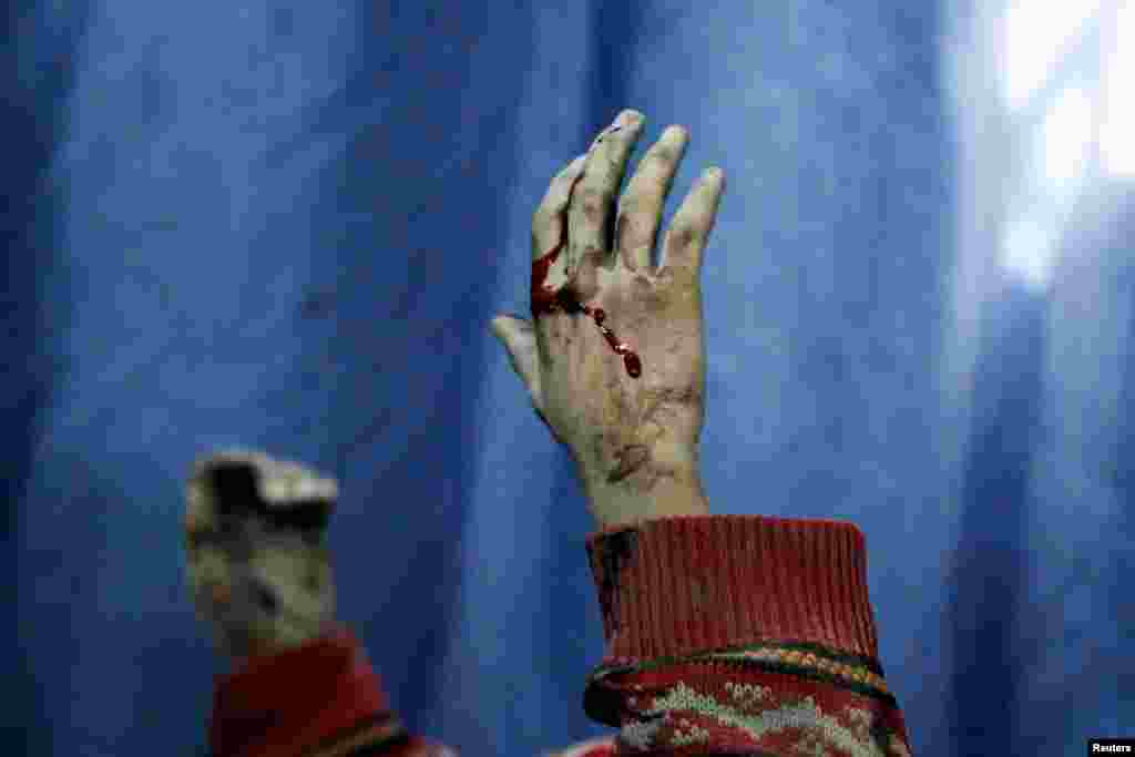 Blood covers the hands of an injured boy lying in a field hospital after what activists said were air strikes by government forces in the Douma neighborhood of Damascus, Syria. Syrian Air Force strikes reportedly killed 82 people in an opposition district outside Damascus following rocket attacks by rebels that hit the government-controlled center of the capital. (Reuters/Mohammed Badra)