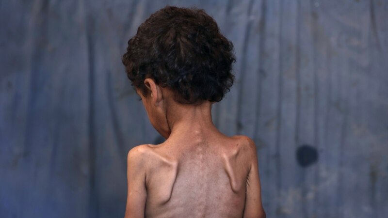 V Gazi se po opozorilih ZN-a širi najhujši scenarij lakote