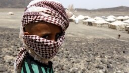 کودک آواره یمنی در استان مأرب