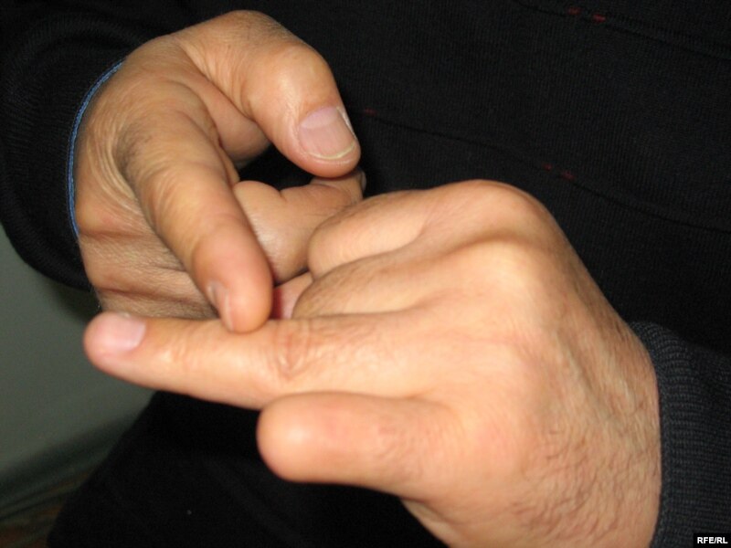 Тахиржан Ахметов показывает отрезанный палец. Алматы, 9 февраля 2009 года.