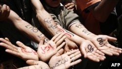 Anti-regime protesters show slogans marked on their arms and hands in Arabic and English during a demonstration in Sanaa on April 4, when more than a dozen new protester deaths were reported.