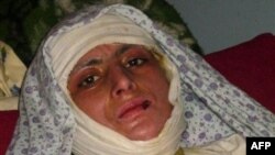خود سوزی