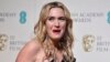 Kate Winslet sosial medianı "gənc qadının vaxt keçirməsi üçün ən ziyanlı yer" adlandırıb. 