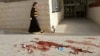 دو زن اسرائیلی در بیت‌المقدس به ضرب چاقو مجروح شدند