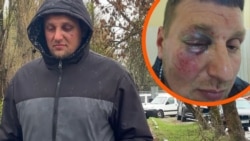 Конфлікт ексвійськового і ТЦК в Луцьку: «Вдарили в обличчя і кинули як ганчірку в машину» (відео)