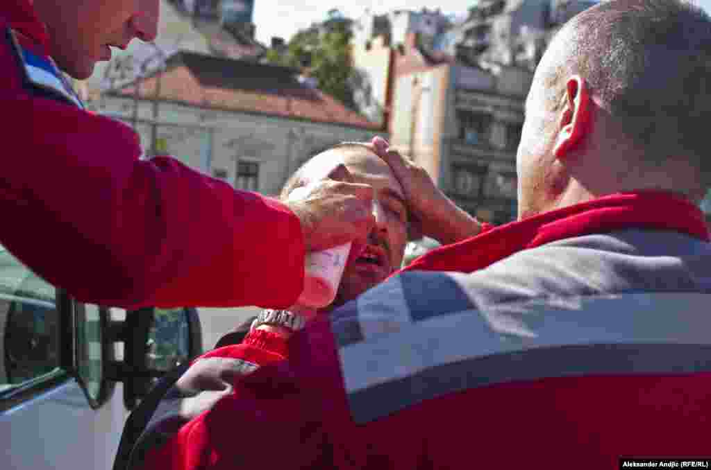 Lekari ukazuju pomoć fotoreporteru koji je povređen tokom sukoba huligana i policije. 