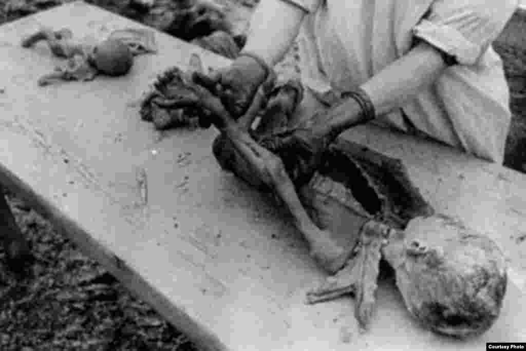 Скелет узника, скончавшегося в концлагере Освенцим.