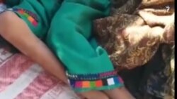 بلوچستان کې تر ۳۰ زره زيات ماشومان خوارځواکي دي