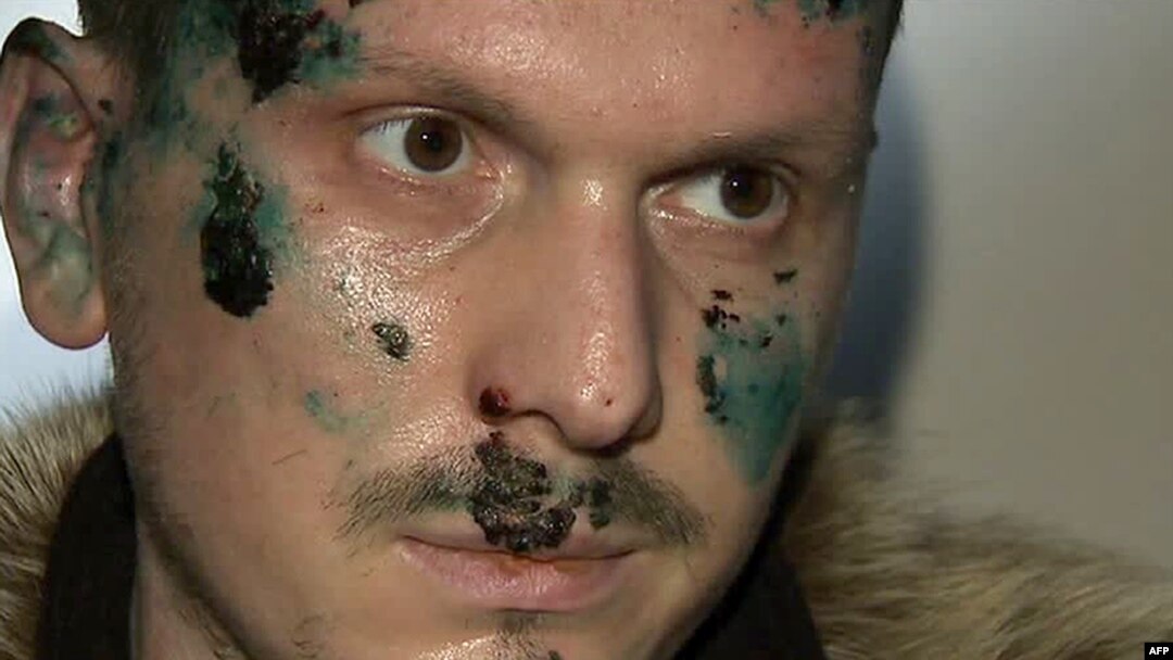 A TV grab shows a man identified as Adam Osmayev, one of the suspected assassins, shortly after his detention in Odesa.