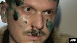 Russian Channel 1 shows a man identified as Adam Osmayev, one of those suspected of conspiring to kill Vladimir Putin.
