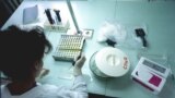 Russia -- HIV russian laboratory
