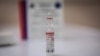 Коронавірус: Словаччина згортає вакцинацію «Спутніком V» – немає охочих