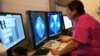 سرطان پستان شایع‌ترین سرطان در میان زنان ایرانی است