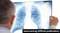 Лікар розглядає рентгенівський знімок вражених коронавірусом легень
