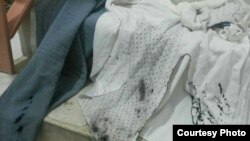 عکسی که خبرگزاری دانا از لباس‌های یکی از قربانیان اسیدپاشی در بوکان منتشر کرده است.