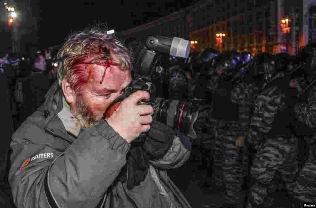 Wounded Reuters photographer Gleb Garanich, who was injured by riot police, takes pictures during a protest on Independence Square.