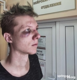 Білоруський студент після катування силовиками