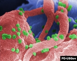 Вірус ВІЧ пад электронным мікраскопам на клетцы-лімфацыце