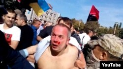 Нестор Шуфрич после избиения в Одессе