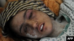 Күйеуі мен оның туыстарынан қорлық көрген Сахар Гүл (15 жаста) ауруханада жатыр. Кабул, 12 қаңтар 2012 жыл. (Көрнекі сурет)