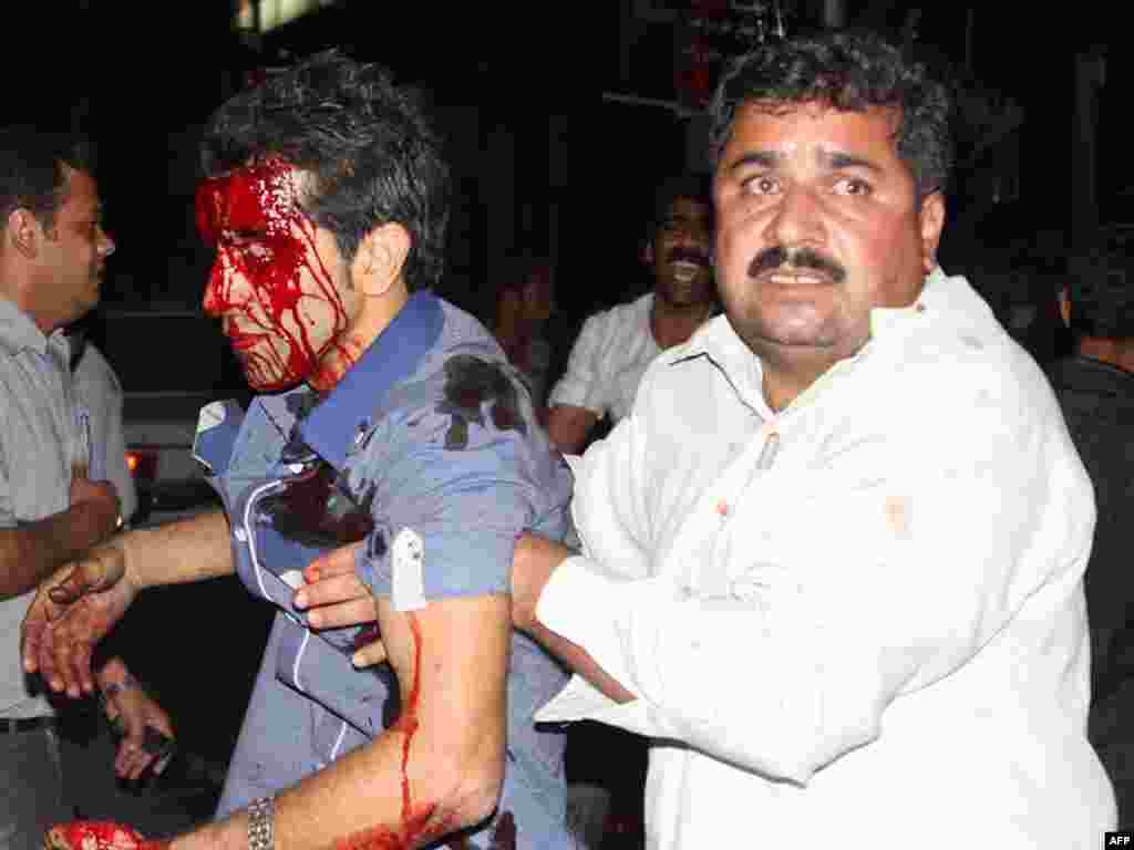 A bloodied victim is tended to outside the Jameh Mosque in the southeastern Iranian city of Zahedan on July 15. Two suicide bombings at a Shi'ite mosque in heavily Sunni southeast Iran killed more than 20 people, including worshippers and members of the Revolutionary Guards.Photo by Amir Rasheki for AFP