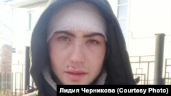 Избитый при задержании Юрий Ямашкин из Куйтуна