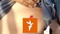 زخمی شدن تعدادی از اهالی روستای ابوالفضل با گلوله‌های ساچمه‌ای پلیس، اهواز