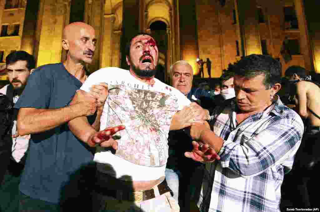 A wounded man in front of Georgia&#39;s parliament. Tear gas, rubber bullets, and water cannons were deployed by police overnight on June 20.&nbsp;