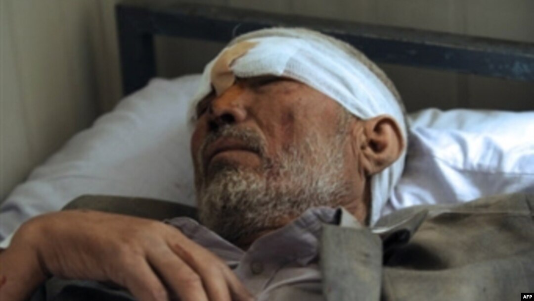 An Afghan man, one of more than 140 people injured in the Kabul embassy attack on July 7