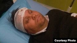 Градоначалникот на Шуто Оризари, Елвис Бајрам, е повреден во тепачка меѓу две групи. Фото: Алсат-М