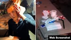 იგორ ნარმანია და რკინის ქანჩი, რომლითაც, სავარაუდოდ, თავს დაესხნენ ნარმანიას