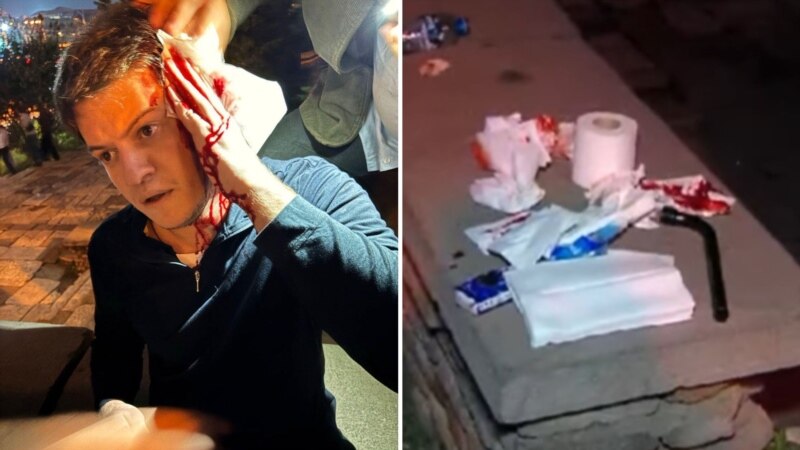 „ინციდენტში მონაწილე იდენტიფიცირებულია და გამოკითხვაზეა“ - შსს ნარმანიაზე სავარაუდო თავდამსხმელზე