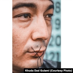 An Afghan refugee sewed his mouth shut to protest conditions in Indonesia.