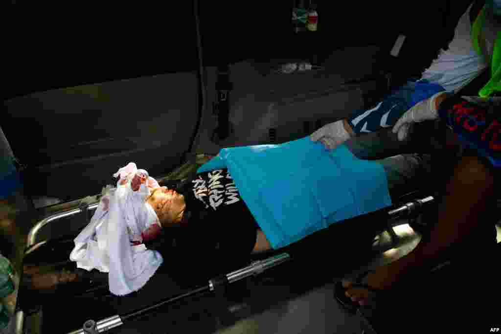Graphic content / The body of Kyal Sin, also known by her Chinese name Deng Jia Xi, lays in an ambulance after being shot in the head during a demonstration against the military coup in Mandalay on March 3, 2021.
