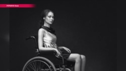 Как девушка с инвалидностью стала успешной фотомоделью (видео)