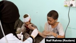 Pamje të fëmijëve të plagosur në Jemen.
