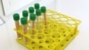 U BiH već postoje laboratorije koje su ovlaštene da rade PCR testiranja za COVID-19, tvrdi Medak