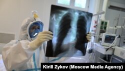 Рентген суретіне қарап тұрған медицина қызметкері. 