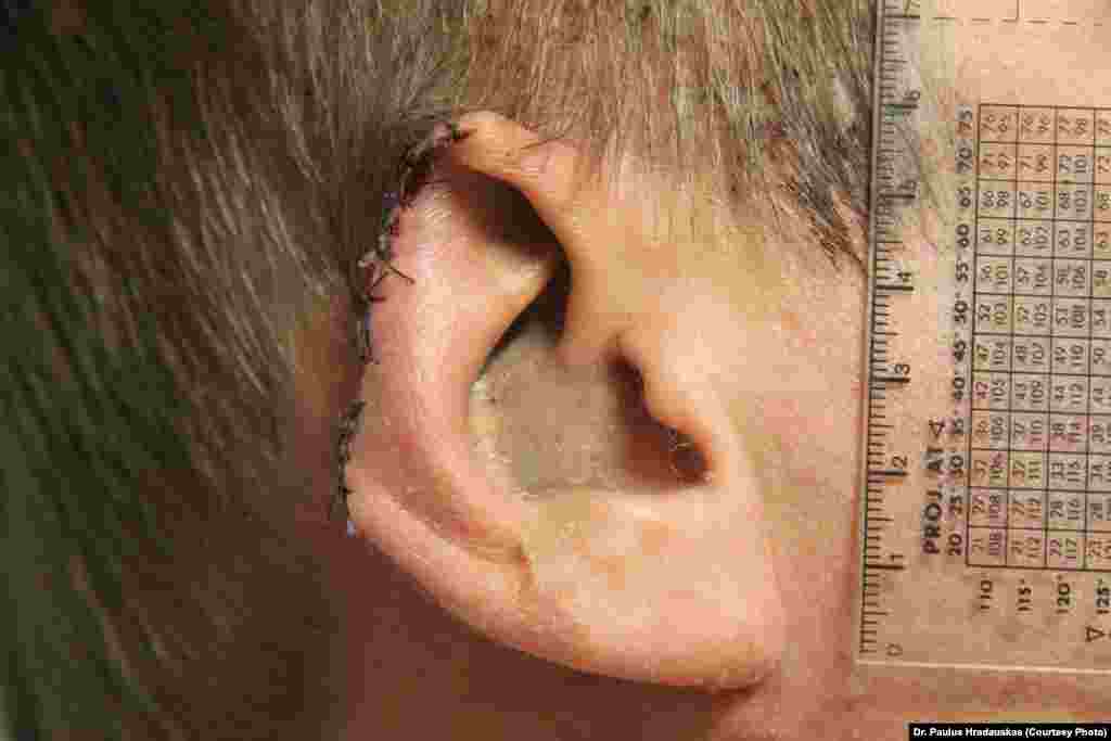 Part of Dmytro Bulatov&#39;s ear was cut off during his abduction.