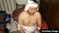 Гражданин Кыргызстана Акжол Калбаев, который подвергся пыткам в Таджикистане. 