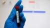 Mediji: Ruski zvaničnici priznali doping program