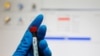 Иркутск: почти 40 спортсменов "заболели" перед допинг-тестом