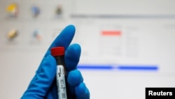 A technician holds a test tube with a blood sample at the Russian anti-doping laboratory in Moscow