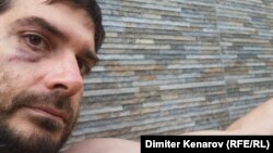 Димитър Кенаров 12 часа след задържането си.