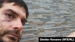 Dimitar Kenarov pictured 12 hours after his detention in police custody