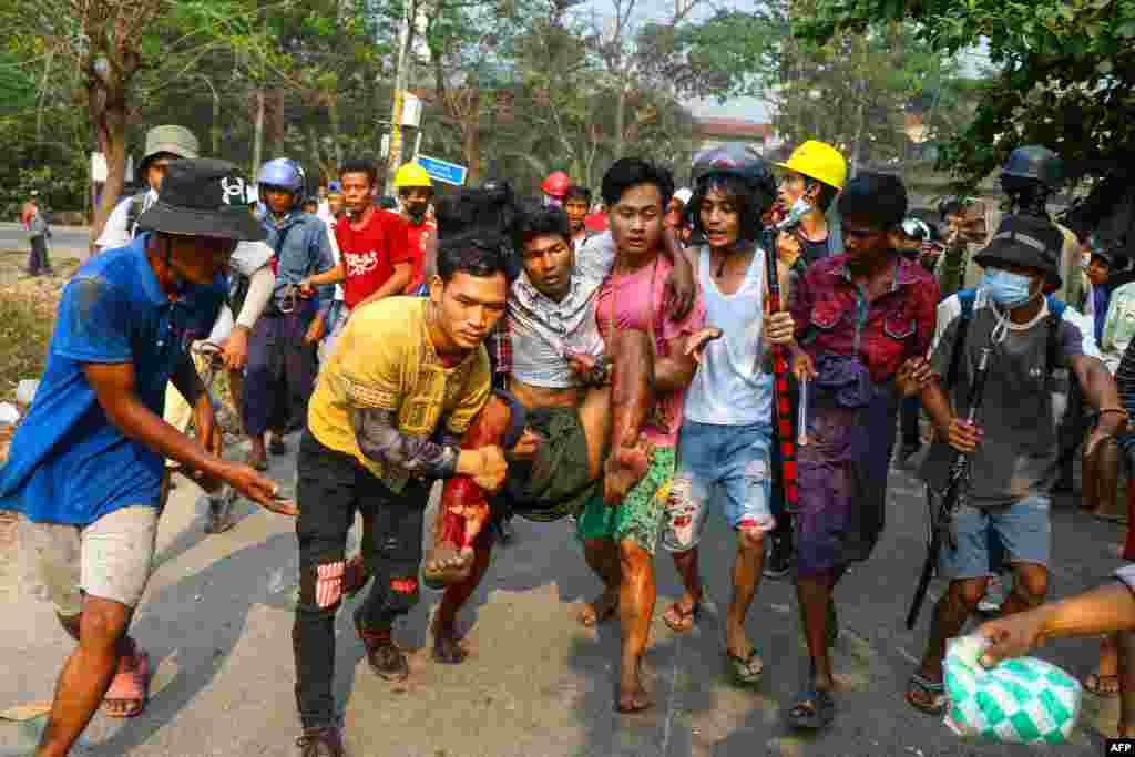 На фото &ndash; житель, пострадавший во время разгона представителями сил безопасности демонстрации против военного переворота. Мужчину доставляют в безопасное место в районе Хлаинг Тарьяр города Янгон, Мьянма, 14 марта 2021