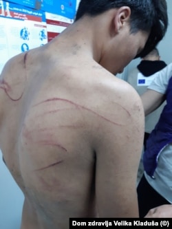 A photograph provided to RFE/RL showing a badly beaten migrant at an outpatient clinic for the Miral camp in Bosnia-Herzegovina (Photo: Dr. Mustafa Hodzic)