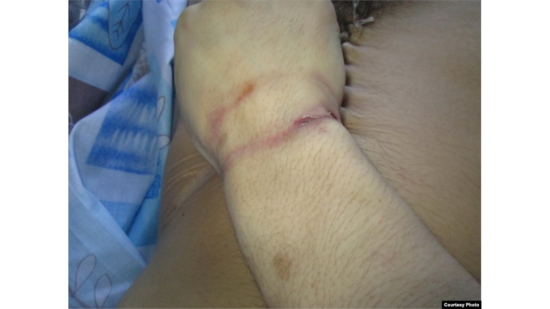 Пискадағы ең ұзын мүше Қыз жігіттің доптарын жұлып алады